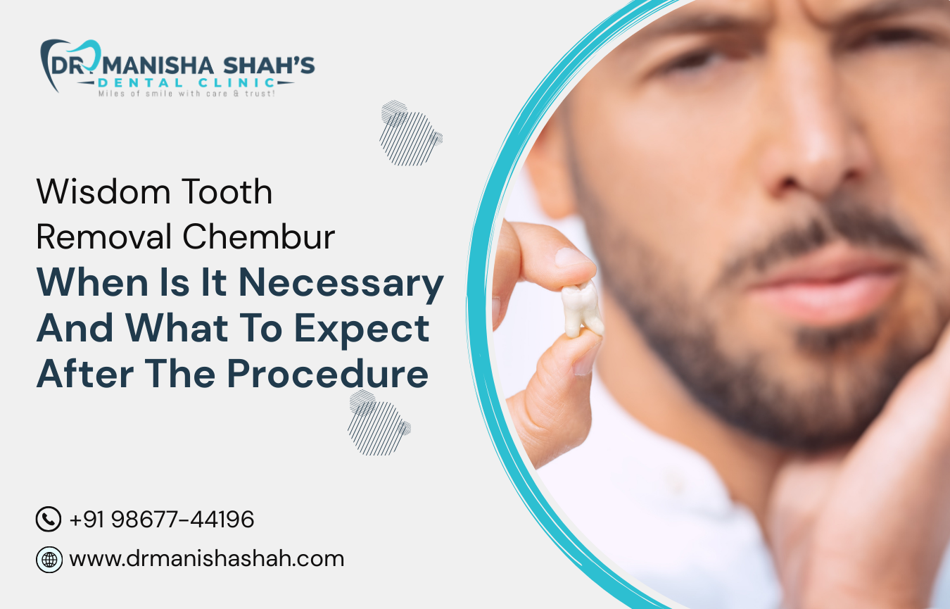 Wisdom Tooth Removal Chembur: When Is It Necessary and What to Expect After the Procedure?